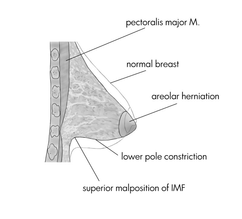 Image chirurgie esthétique