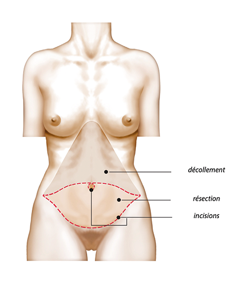 Image chirurgie esthétique