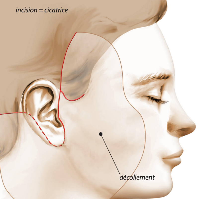 Image chirurgie esthétique