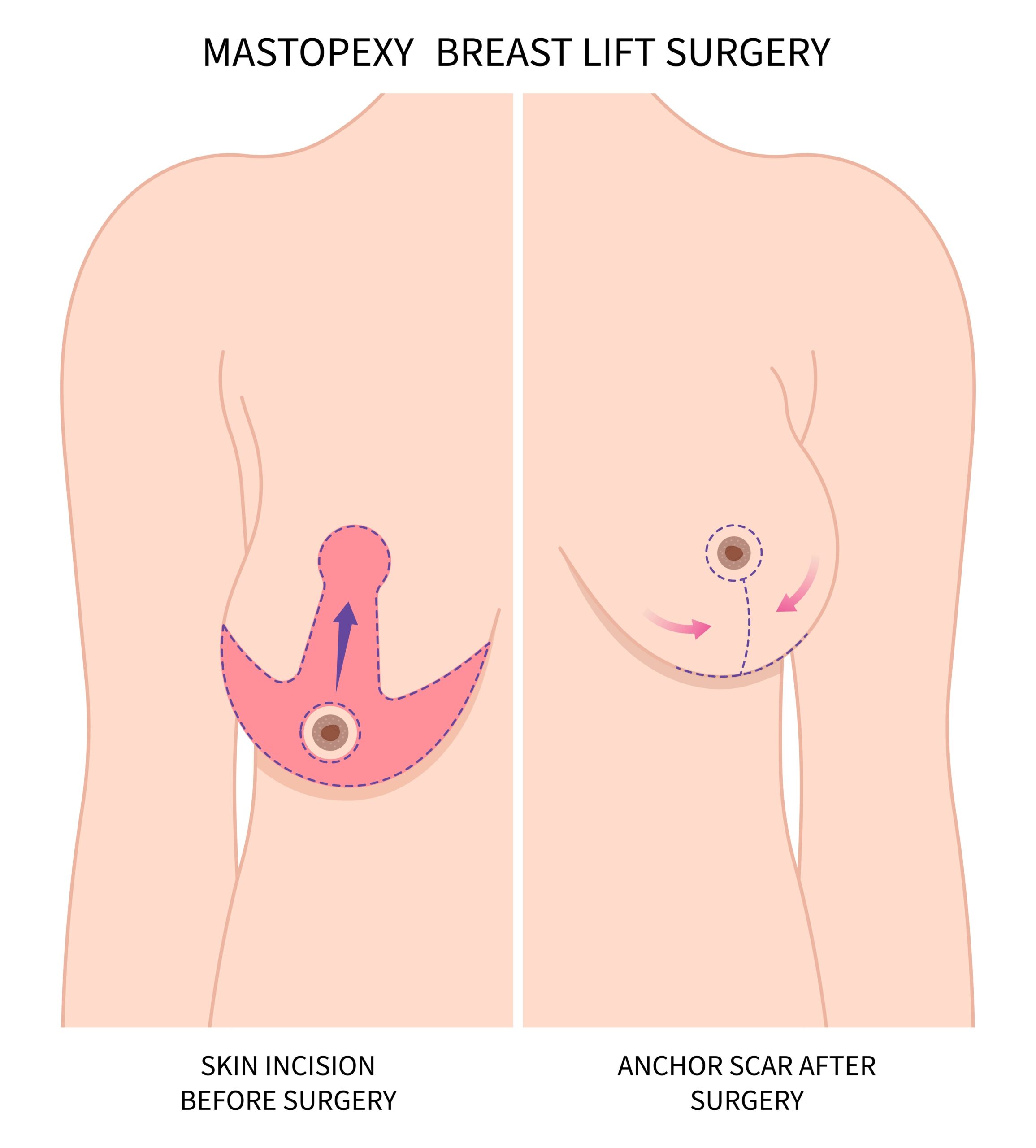 Image chirurgie esthétique