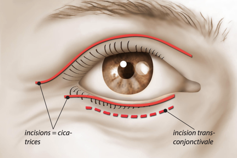 Image chirurgie esthétique