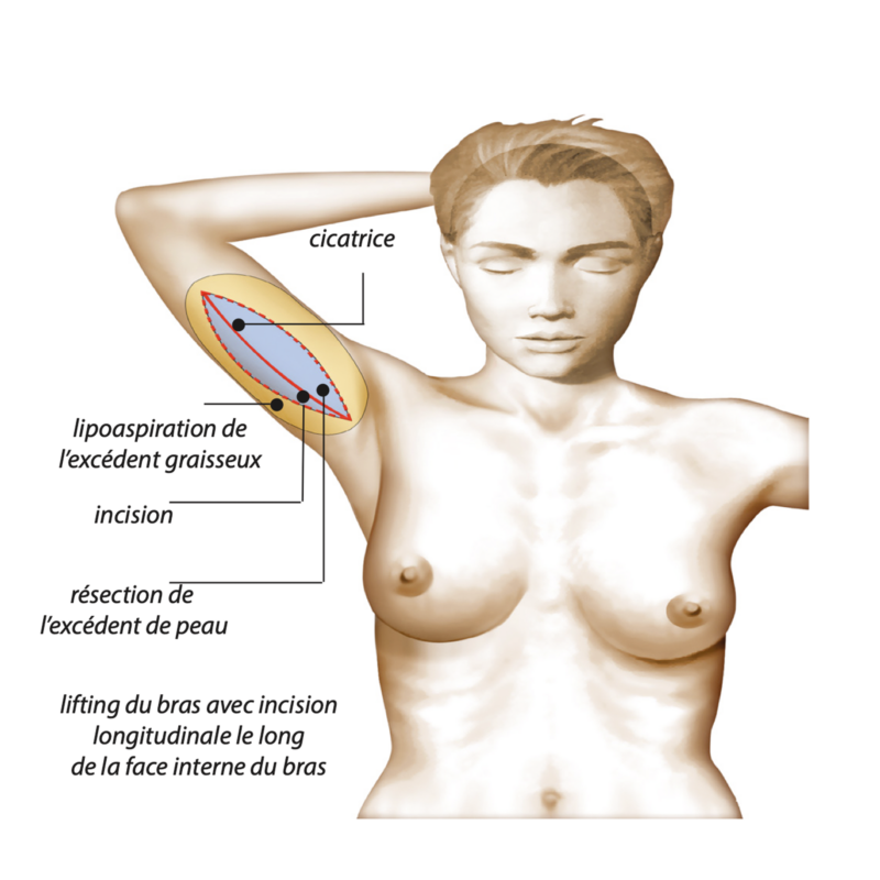 Image chirurgie esthétique