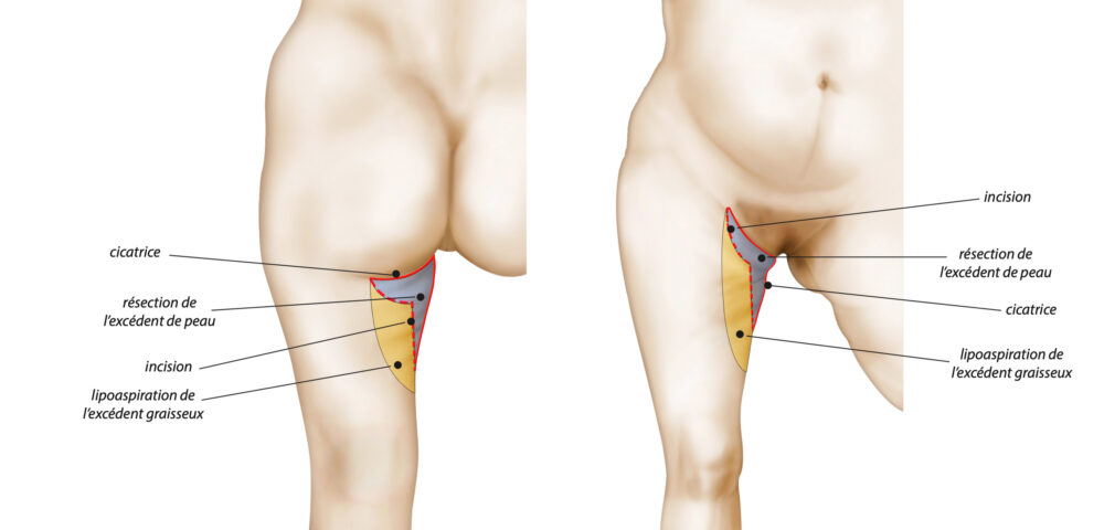 Image chirurgie esthétique