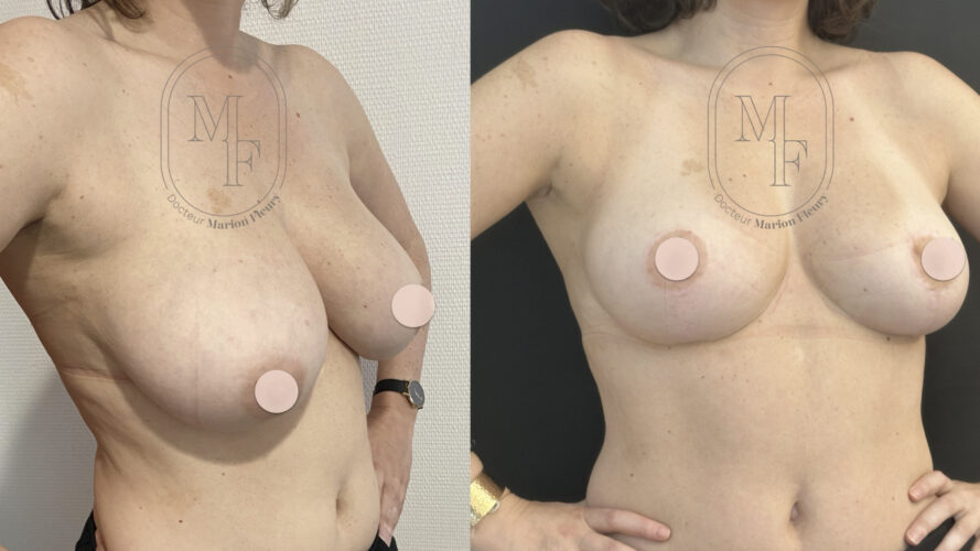 Image chirurgie esthétique