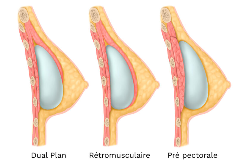 Image chirurgie esthétique