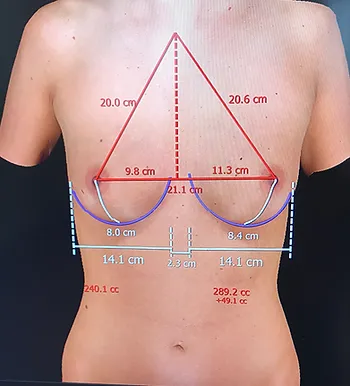 Image chirurgie esthétique