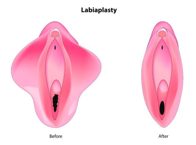 Image chirurgie esthétique