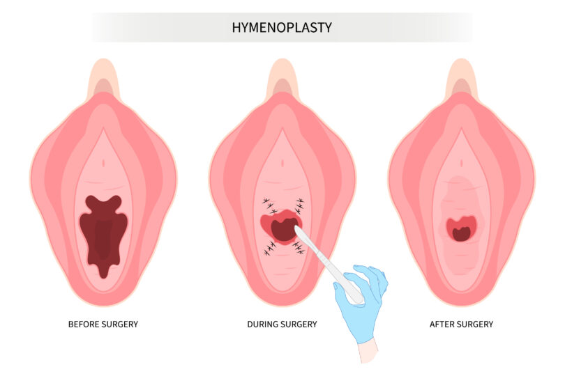 Image chirurgie esthétique